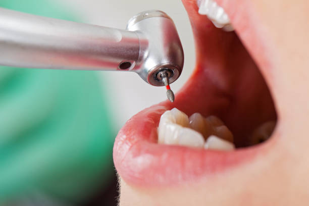 Best Emergency Cosmetic Dentistry in Ashland, OR